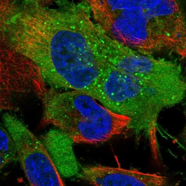 Neuropilin 2 Antibody in Immunocytochemistry (ICC/IF)