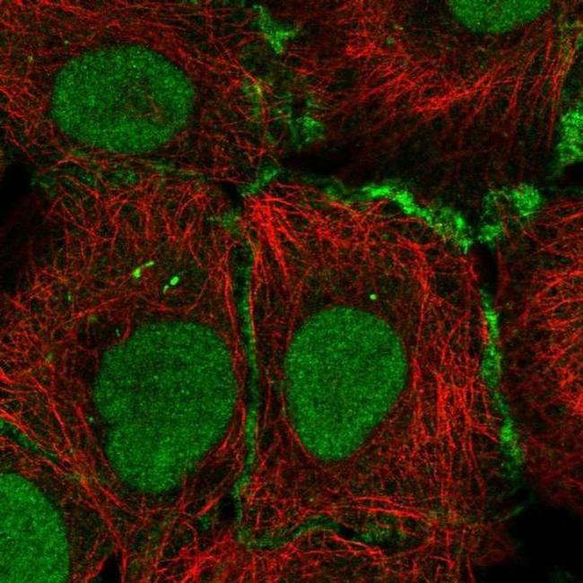 Connexin 30.3 Antibody in Immunocytochemistry (ICC/IF)