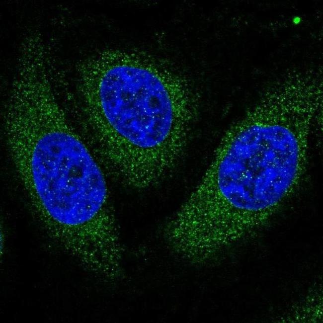 ASPH Antibody in Immunocytochemistry (ICC/IF)