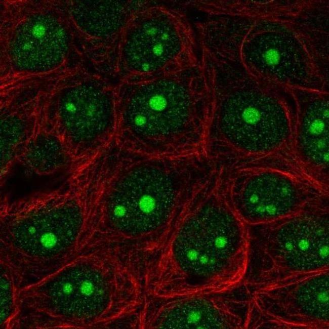 EXOSC5 Antibody in Immunocytochemistry (ICC/IF)