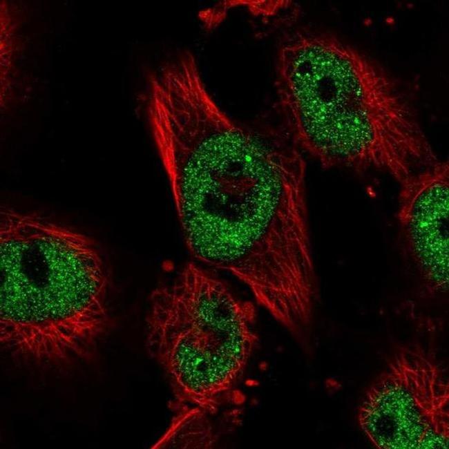 PHF15 Antibody in Immunocytochemistry (ICC/IF)