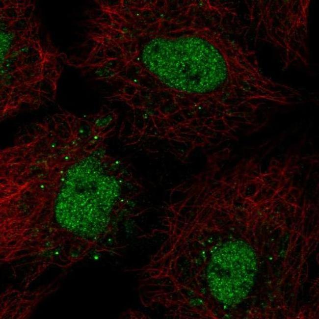 BarX1 Antibody in Immunocytochemistry (ICC/IF)