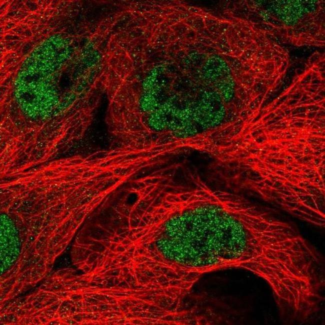 MED29 Antibody in Immunocytochemistry (ICC/IF)