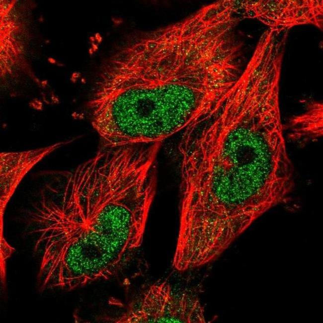 NUP37 Antibody in Immunocytochemistry (ICC/IF)