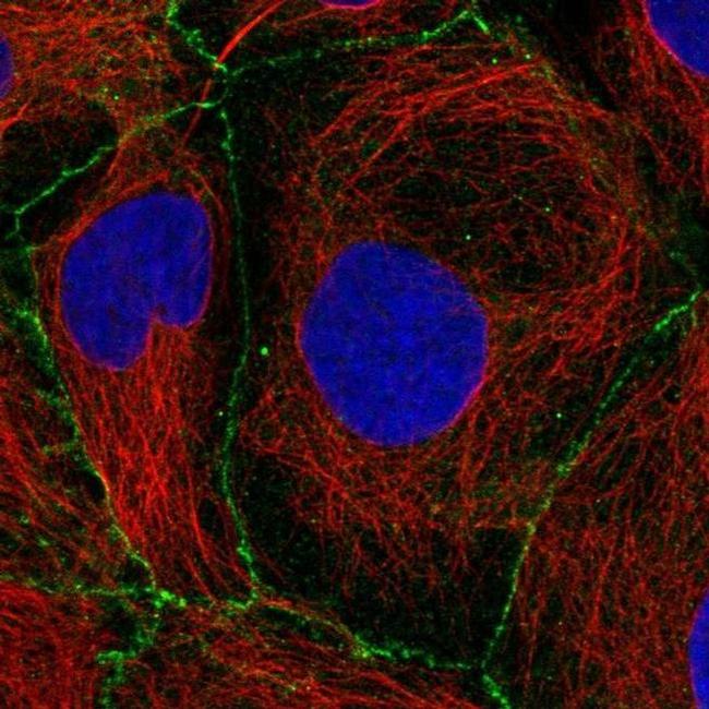 PKP2 Antibody in Immunocytochemistry (ICC/IF)