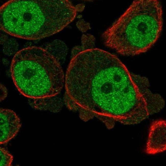 KCNN3 Antibody in Immunocytochemistry (ICC/IF)