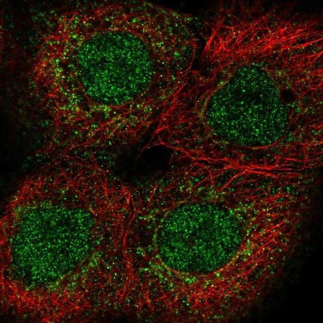 PUS1 Antibody in Immunocytochemistry (ICC/IF)