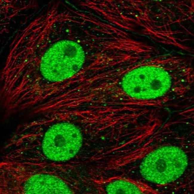 DCP2 Antibody in Immunocytochemistry (ICC/IF)