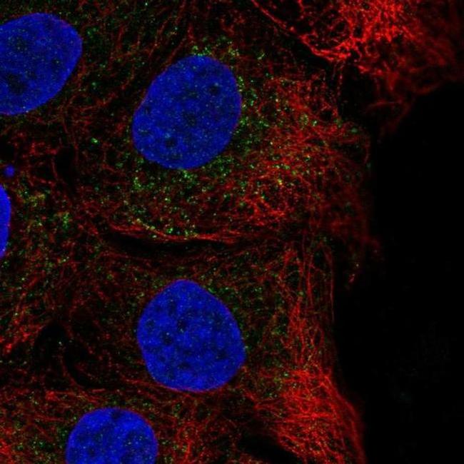 CHST14 Antibody in Immunocytochemistry (ICC/IF)