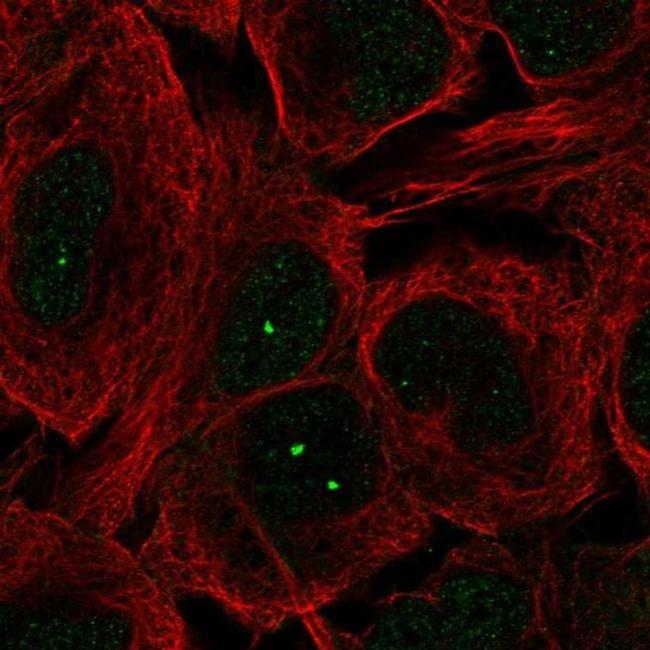 IDAS Antibody in Immunocytochemistry (ICC/IF)