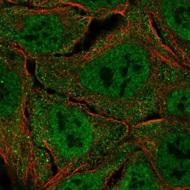 UBE1L Antibody in Immunocytochemistry (ICC/IF)