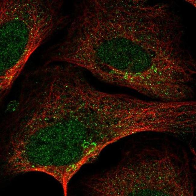 SLA2 Antibody in Immunocytochemistry (ICC/IF)