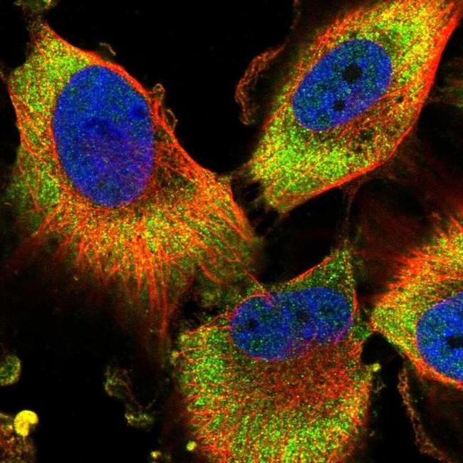 PFDN2 Antibody in Immunocytochemistry (ICC/IF)