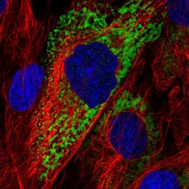 COL11A1 Antibody in Immunocytochemistry (ICC/IF)