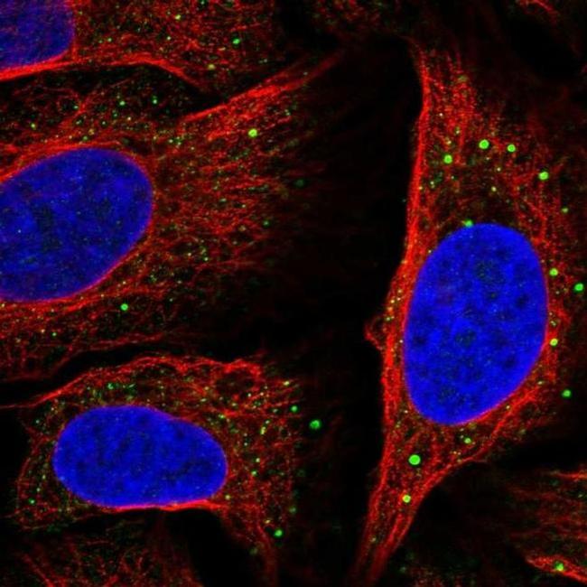 SLC14A1 Antibody in Immunocytochemistry (ICC/IF)