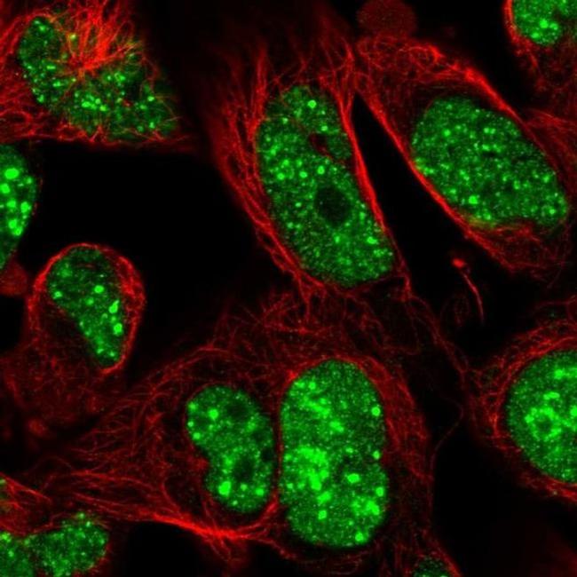 RNF169 Antibody in Immunocytochemistry (ICC/IF)