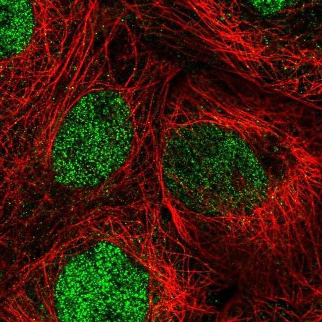 DIS3 Antibody in Immunocytochemistry (ICC/IF)