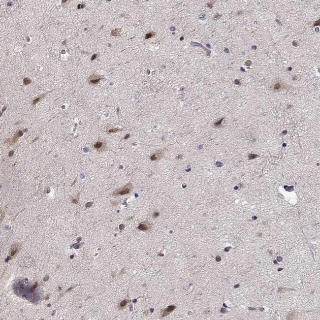 TESPA1 Antibody in Immunohistochemistry (IHC)