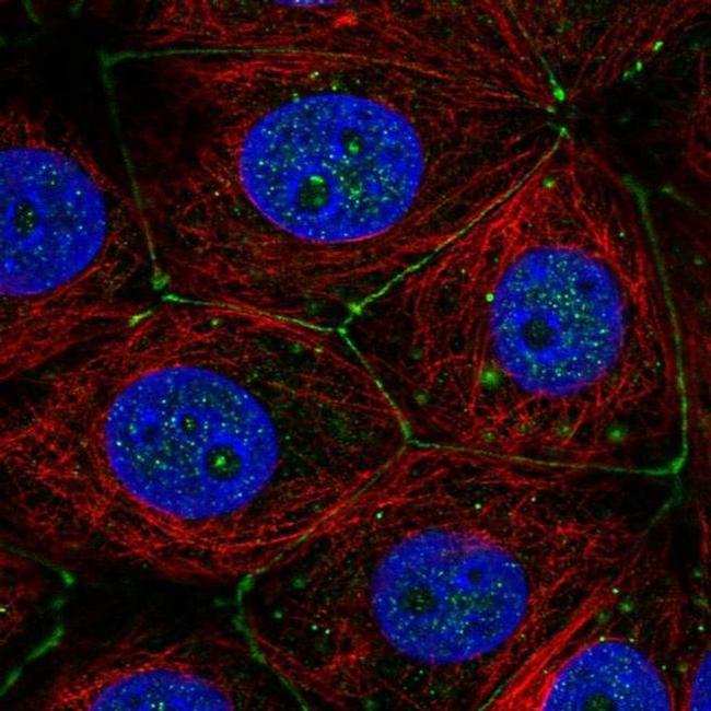 PLXNA3 Antibody in Immunocytochemistry (ICC/IF)