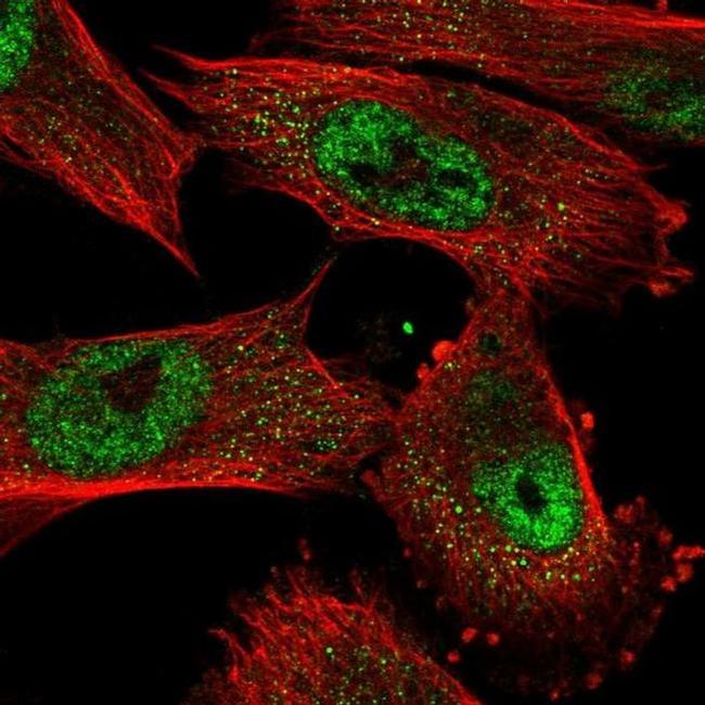 OIP5 Antibody in Immunocytochemistry (ICC/IF)