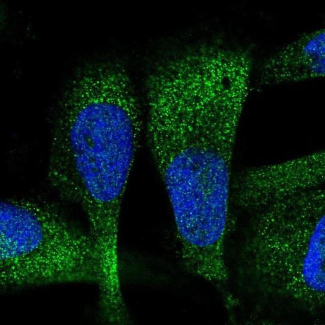 ZC3H7A Antibody in Immunocytochemistry (ICC/IF)