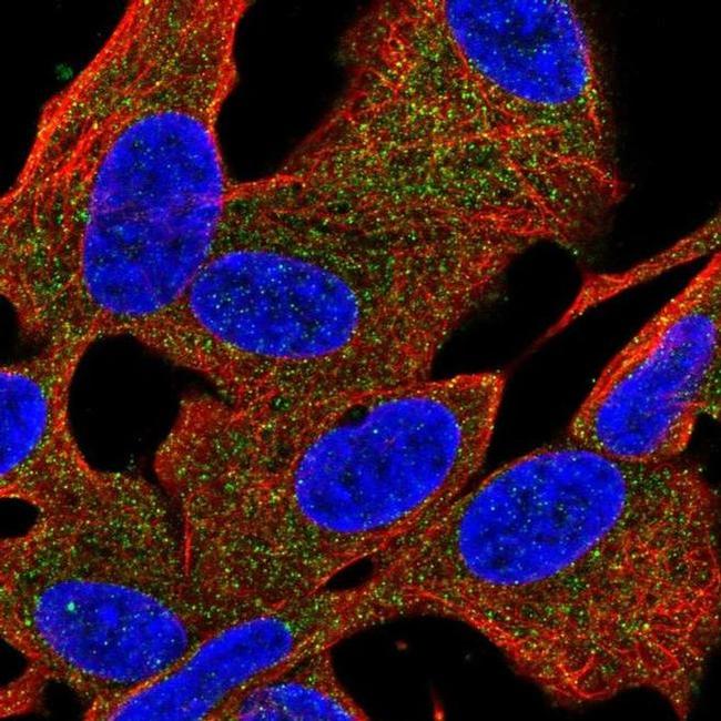 PDE6B Antibody in Immunocytochemistry (ICC/IF)