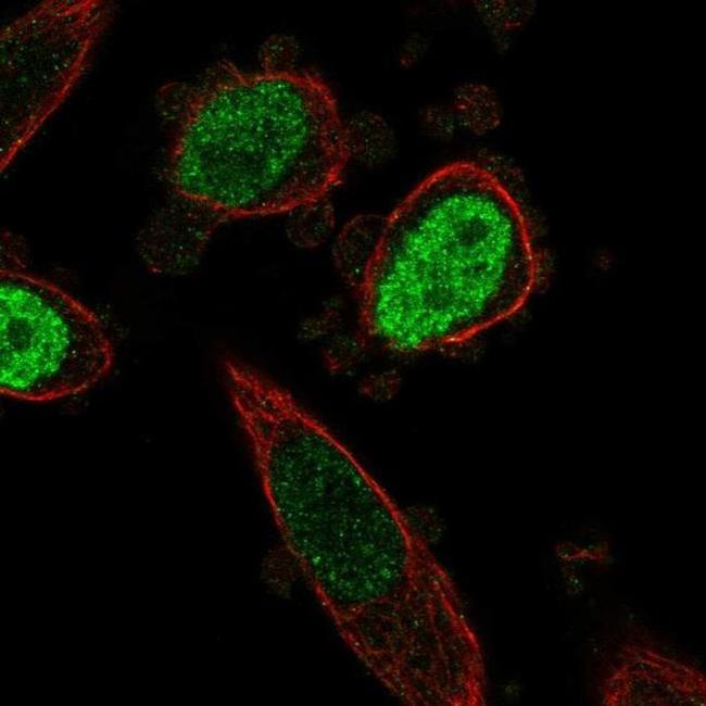 ONECUT3 Antibody in Immunocytochemistry (ICC/IF)