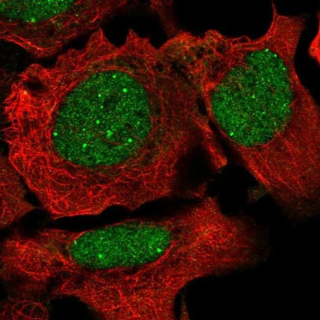 SRC2 Antibody in Immunocytochemistry (ICC/IF)