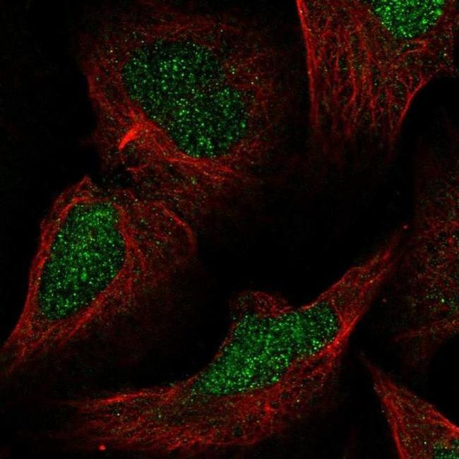 MLH3 Antibody in Immunocytochemistry (ICC/IF)