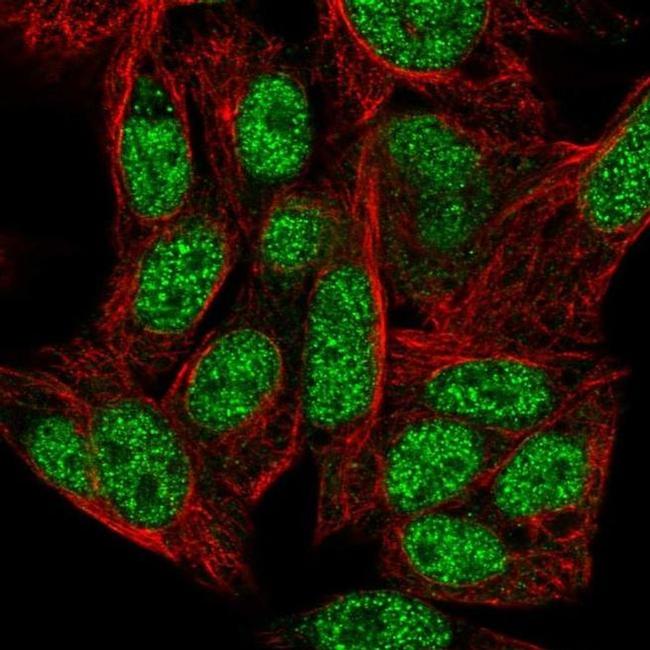 ZNF556 Antibody in Immunocytochemistry (ICC/IF)