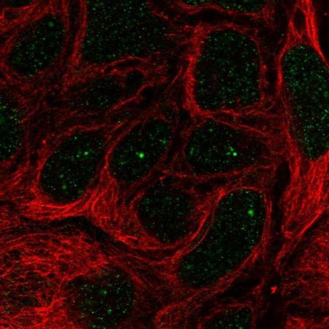 IGHMBP2 Antibody in Immunocytochemistry (ICC/IF)