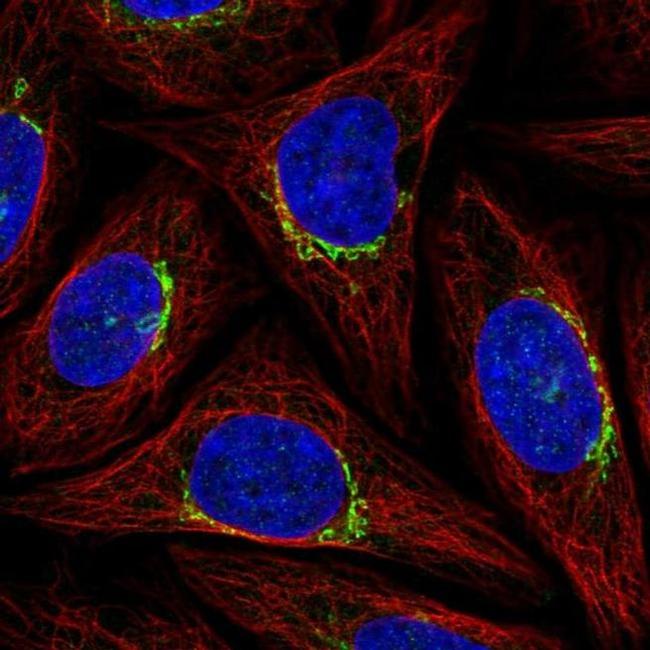 PPP1R15B Antibody in Immunocytochemistry (ICC/IF)