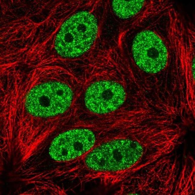 YLPM1 Antibody in Immunocytochemistry (ICC/IF)