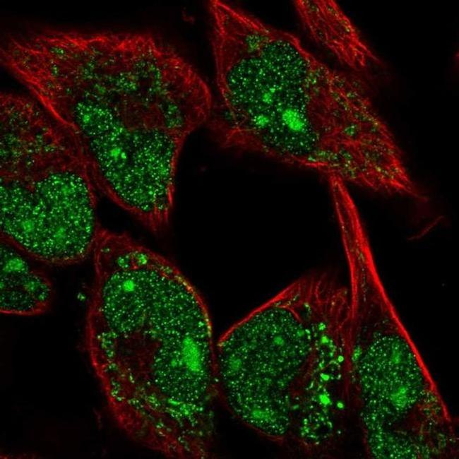 MYBPH Antibody in Immunocytochemistry (ICC/IF)