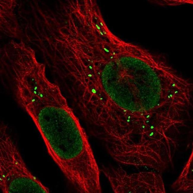 ARHGAP25 Antibody in Immunocytochemistry (ICC/IF)