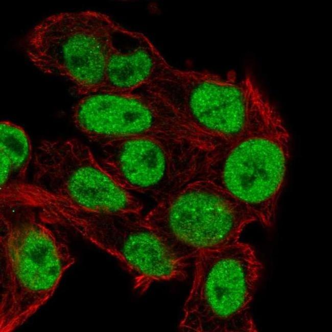 TRIM24 Antibody in Immunocytochemistry (ICC/IF)