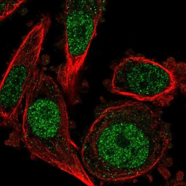 MKP2 Antibody in Immunocytochemistry (ICC/IF)