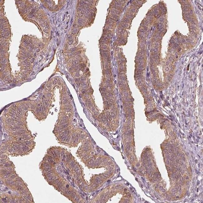 RPS5 Antibody in Immunohistochemistry (IHC)