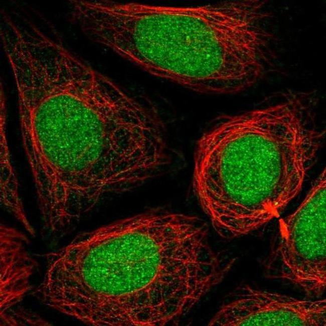 PHF8 Antibody in Immunocytochemistry (ICC/IF)