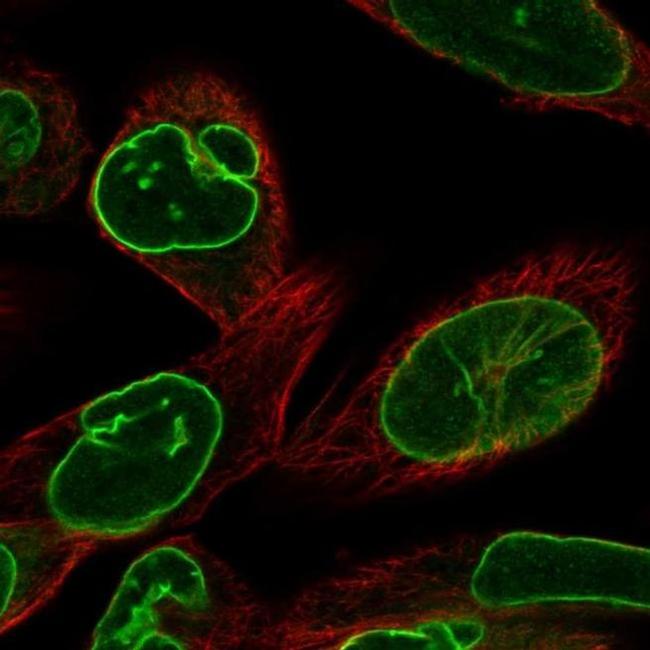 Lamin B Receptor Antibody in Immunocytochemistry (ICC/IF)