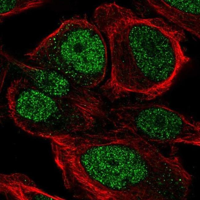 ZNF561 Antibody in Immunocytochemistry (ICC/IF)