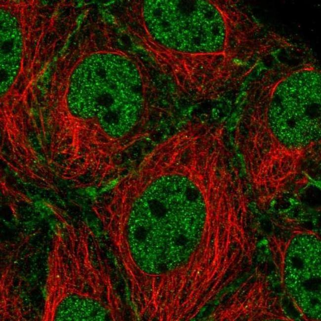 SYCP2 Antibody in Immunocytochemistry (ICC/IF)