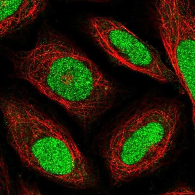 TEF1 Antibody in Immunocytochemistry (ICC/IF)