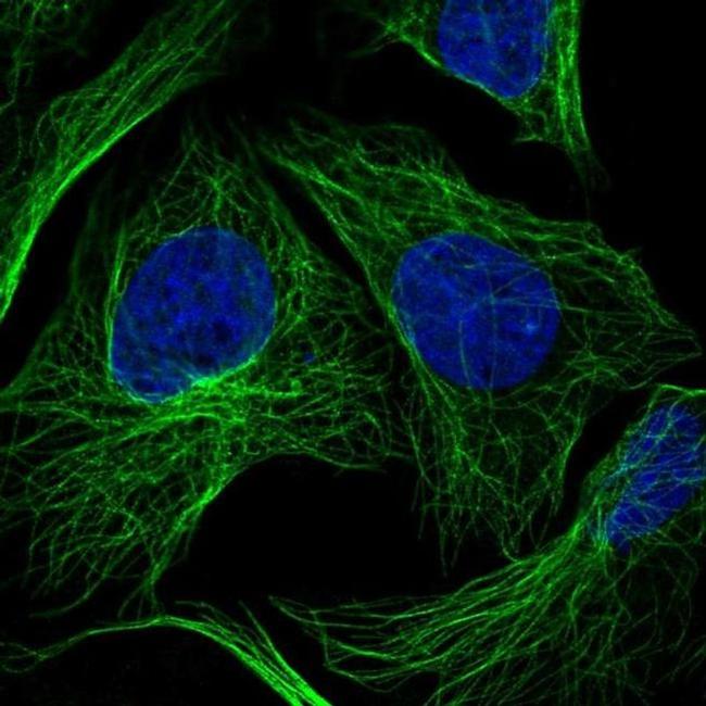 HS3ST3A1 Antibody in Immunocytochemistry (ICC/IF)