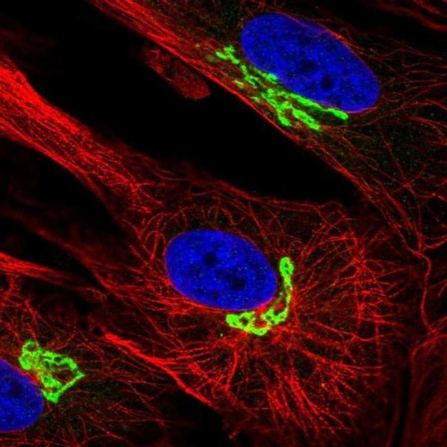 ARL1 Antibody in Immunocytochemistry (ICC/IF)