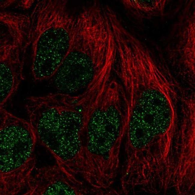 PITX2 Antibody in Immunocytochemistry (ICC/IF)