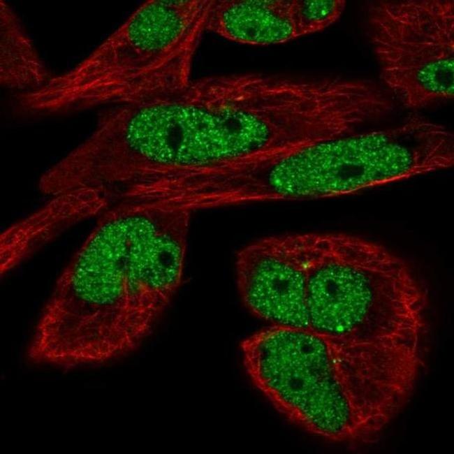 EYA3 Antibody in Immunocytochemistry (ICC/IF)