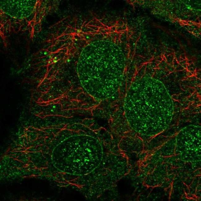 CYP2B6 Antibody in Immunocytochemistry (ICC/IF)