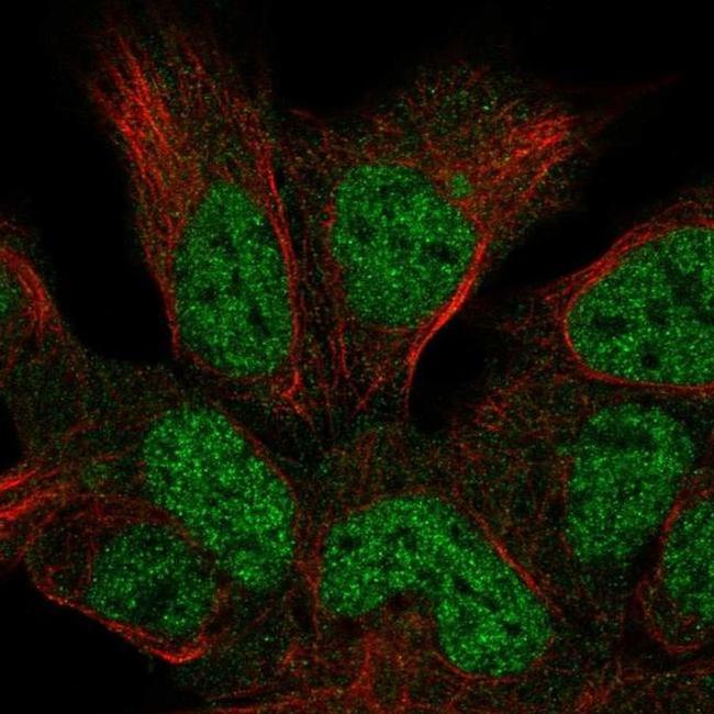 HUS1B Antibody in Immunocytochemistry (ICC/IF)