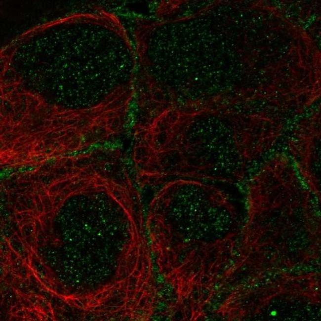 OSR2 Antibody in Immunocytochemistry (ICC/IF)